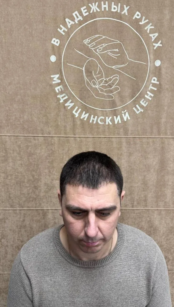 Углы линии роста до пересадки, пациент 8